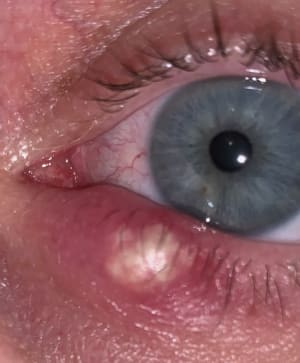 Toh368gv8pdcdp9pxtaz - Eugenol