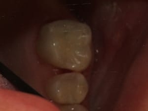 Tout flou vh4ncg - Eugenol