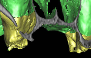 Tur 3d25 k3atyk - Eugenol