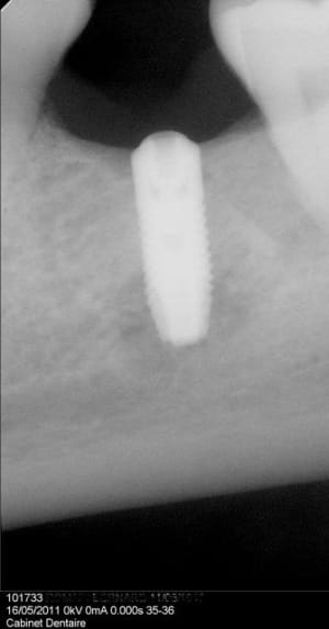 Tx36 qjhfsq - Eugenol