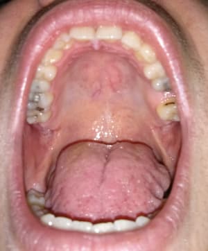 U cmixuy - Eugenol