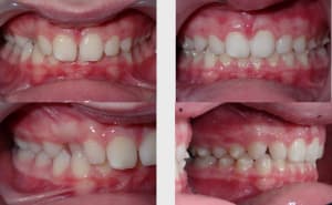 Ubdr2adggnuk5ejezh0hyt1c9lkd - Eugenol