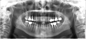 Un4lzrfqjiwj4q4km2lz - Eugenol