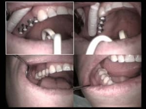 Un autre beau cas haut droit fin lawzln - Eugenol