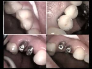 Un autre beau cas haut gauche fin 1 xdn7nk - Eugenol