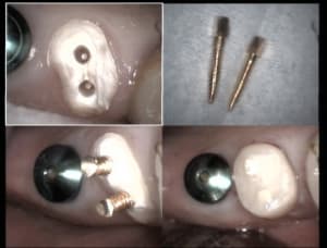 Un cas difficile restit 15 sans digue vraiment désolé hi hi hi hp4gx9 - Eugenol