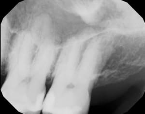 Vceebgbtgn7oeoolvko3 - Eugenol