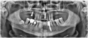 Vk6vv77k1czx3ftxlyfsfs0kemhx - Eugenol