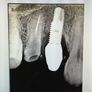 Vnh0qg2wd55asy57bjle - Eugenol