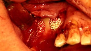 Vue wvvtmj - Eugenol