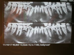 Vxgzfrywoj9layl8iejc - Eugenol
