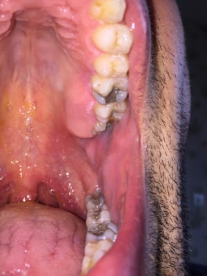 Wb5zzebmbwvhobqkeq0f - Eugenol