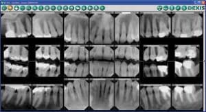 X ray t3ykgl - Eugenol