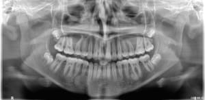 Xpzudwp2c4pscwdiqbdjqw7h9v80 - Eugenol