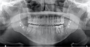 Xvtgd8g9aoelu8iy6xop - Eugenol