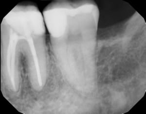 Yqgx2wkw6mtlmgzlfauc - Eugenol