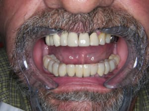 Z la finition au 3e rdv    ayi29y - Eugenol