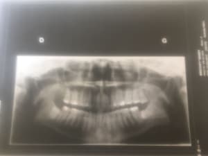 Zdfeyzql86f1dqlgjhjs - Eugenol