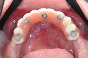 Zf6kw3d8fqwhqrcwucgy - Eugenol