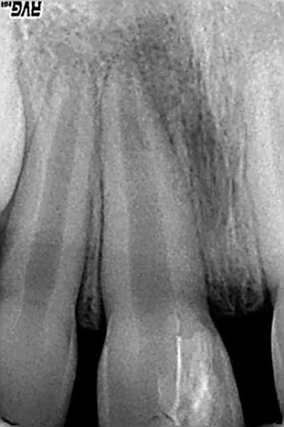 À 5 semaines oc1n1l - Eugenol