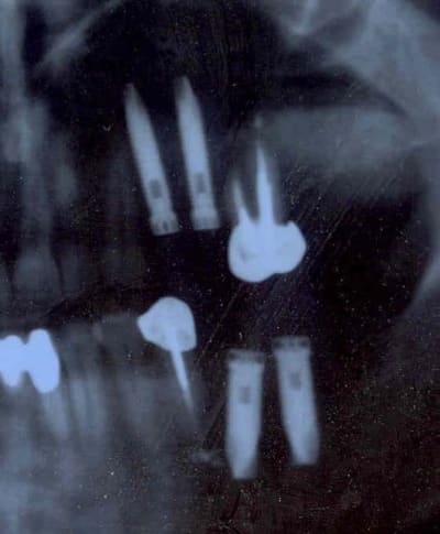 Çradios 1 i3iq0o - Eugenol