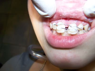 000 0106 suifji - Eugenol