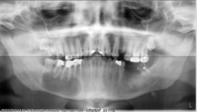 001pr avj1g5 - Eugenol