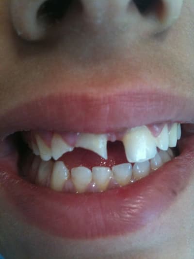 001 unw4nr - Eugenol