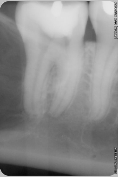 002 ugi8kt - Eugenol