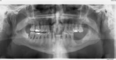 002 uhqyei - Eugenol