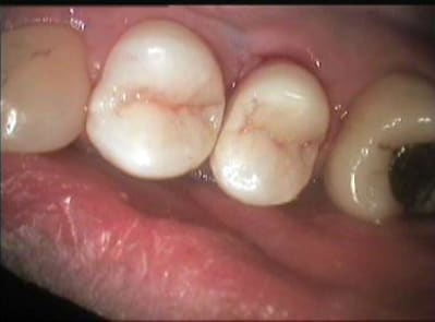 004 urylgv - Eugenol