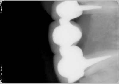 005 nk7giy - Eugenol