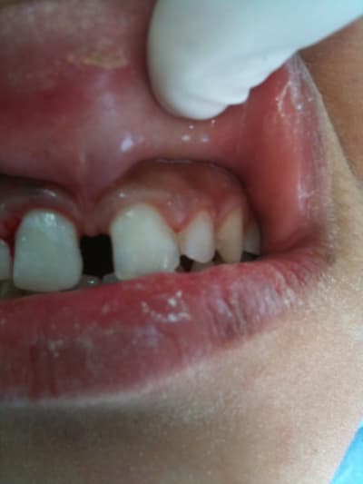 005 ze24dd - Eugenol