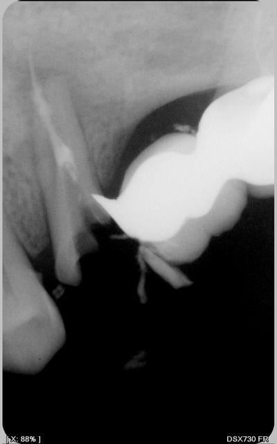 006 iyjlpz - Eugenol