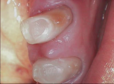 006 w44d2x - Eugenol