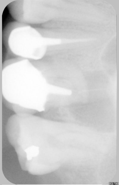 007 bimdvu - Eugenol