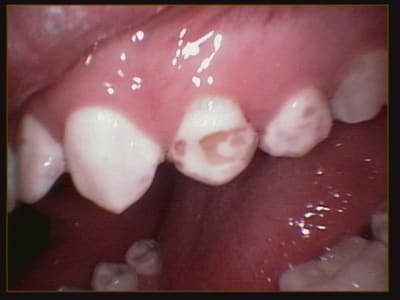 009 kohgwx - Eugenol