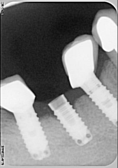 011pr afrdtp - Eugenol