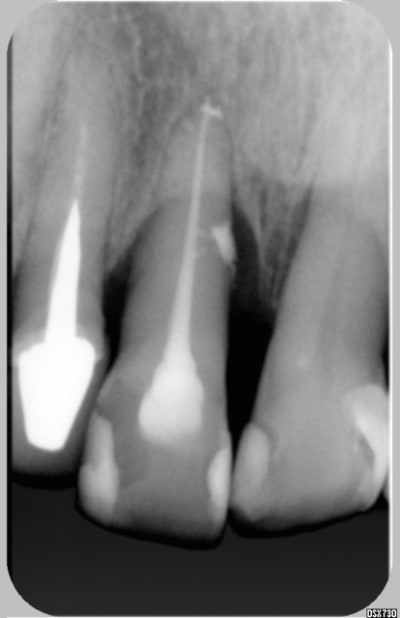 011 rn3dnu - Eugenol
