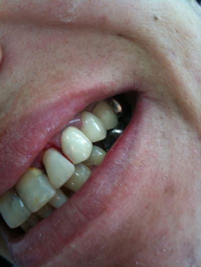 015 q6iosc - Eugenol