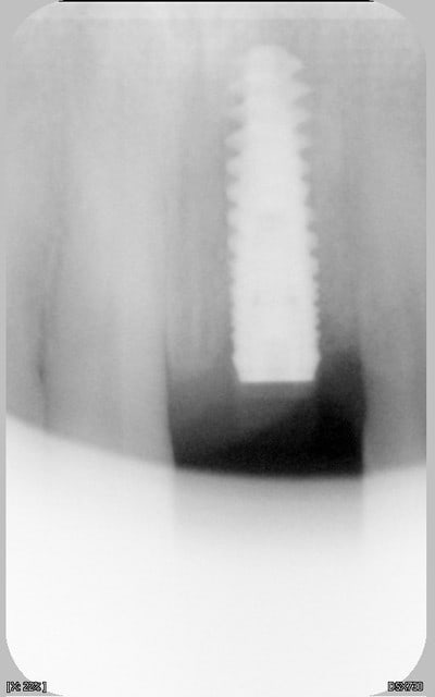 016 eizfp0 - Eugenol