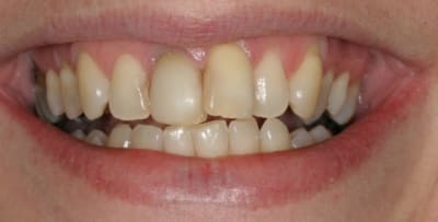 01 initial lb7are - Eugenol