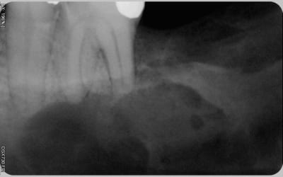 020 l39g1f - Eugenol