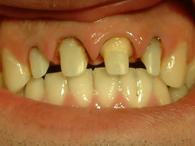 04051409 fdequ2 - Eugenol