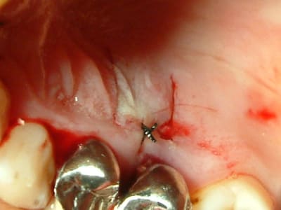 04101409 wmuraz - Eugenol