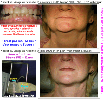 050710 22amartyrs ehhevo - Eugenol