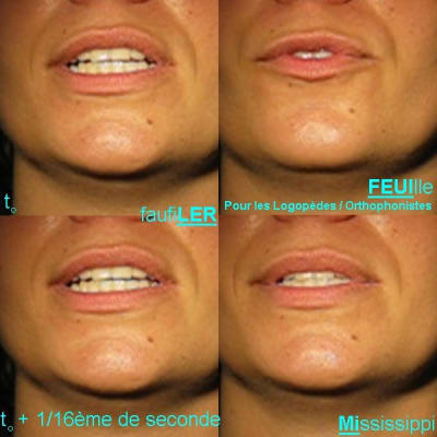 050712 test phonetique hvhpoo - Eugenol