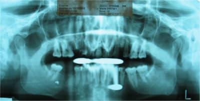 051010 pano zfzxpu - Eugenol