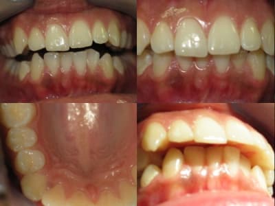 051102 exdt pscgbc - Eugenol