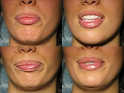 051102 mlab cpm52x - Eugenol